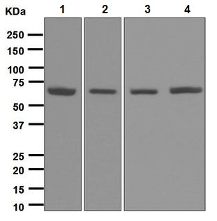 Western blot - Anti-Arginyl tRNA synthetase antibody [EPR6298] (ab128956)