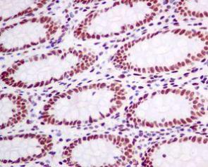 Immunohistochemistry (Formalin/PFA-fixed paraffin-embedded sections) - Anti-CtBP1 antibody [EPR6800] (ab129181)