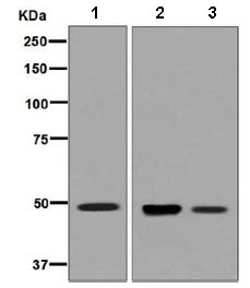 Western blot - Anti-HGD antibody [EPR7874] (ab131035)