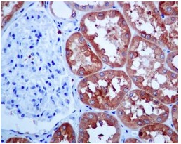 Immunohistochemistry (Formalin/PFA-fixed paraffin-embedded sections) - Anti-HGD antibody [EPR7874] (ab131035)