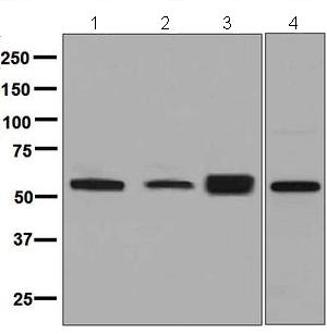Western blot - Anti-LACTB antibody [EPR8502] (ab131171)