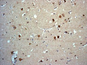 Immunohistochemistry (Formalin/PFA-fixed paraffin-embedded sections) - Anti-CNTN4 antibody [EPR8736] (ab131285)