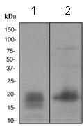 Western blot - Anti-GCDFP 15 antibody [EPR1582] (ab133290)