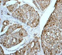 Immunohistochemistry (Formalin/PFA-fixed paraffin-embedded sections) - Anti-GCDFP 15 antibody [EPR1582] (ab133290)