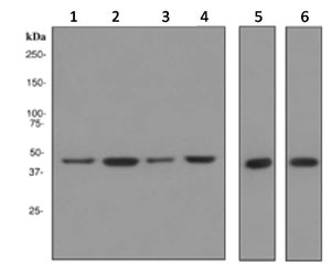 Western blot - Anti-NSE antibody [EPR3378] (ab133309)