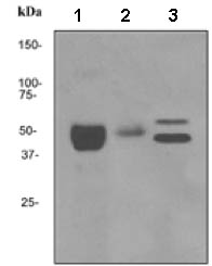 Western blot - Anti-Fibrinopeptide B antibody [EPR3083] (ab133359)