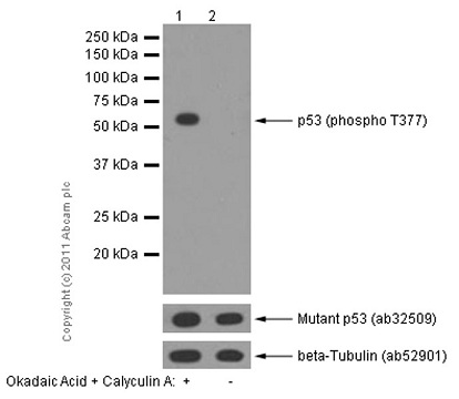 Western blot - Anti-p53 (phospho T377) antibody [EPR5678] (ab133451)