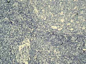 Immunohistochemistry (Formalin/PFA-fixed paraffin-embedded sections)-Anti-alpha 1 Fetoprotein antibody [EPAFP61](ab133617)