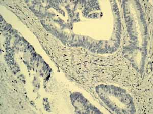 Immunohistochemistry (Formalin/PFA-fixed paraffin-embedded sections) - Anti-alpha 1 Fetoprotein antibody [EPAFP61] (ab133617)