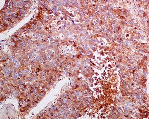 Immunohistochemistry (Formalin/PFA-fixed paraffin-embedded sections) - Anti-alpha 1 Fetoprotein antibody [EPAFP61] (ab133617)