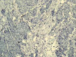 Immunohistochemistry (Formalin/PFA-fixed paraffin-embedded sections)-Anti-alpha 1 Fetoprotein antibody [EPAFP61](ab133617)