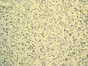 Immunohistochemistry (Formalin/PFA-fixed paraffin-embedded sections)-Anti-alpha 1 Fetoprotein antibody [EPAFP61](ab133617)