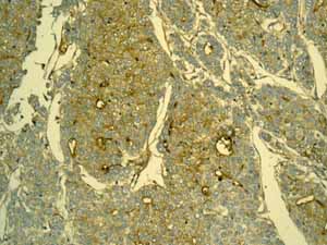 Immunohistochemistry (Formalin/PFA-fixed paraffin-embedded sections)-Anti-alpha 1 Fetoprotein antibody [EPAFP61](ab133617)