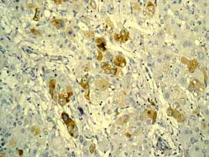 Immunohistochemistry (Formalin/PFA-fixed paraffin-embedded sections)-Anti-alpha 1 Fetoprotein antibody [EPAFP61](ab133617)