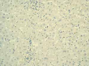 Immunohistochemistry (Formalin/PFA-fixed paraffin-embedded sections)-Anti-alpha 1 Fetoprotein antibody [EPAFP61](ab133617)