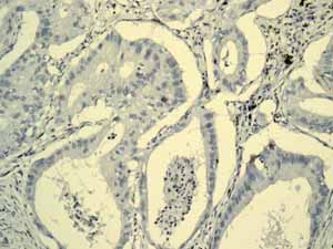 Immunohistochemistry (Formalin/PFA-fixed paraffin-embedded sections)-Anti-alpha 1 Fetoprotein antibody [EPAFP61](ab133617)