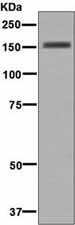 Western blot - Anti-Desmoglein 1 antibody [EP6765] (ab133662)