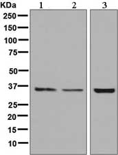 Western blot - Anti-Aquaporin 8 antibody [EPR8397] (ab133667)