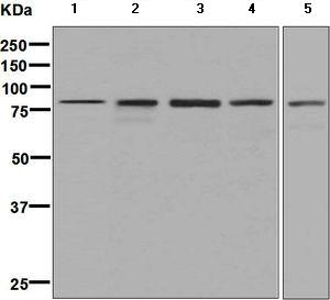 Western blot - Anti-Methylmalo<i></i>nyl Coenzyme A mutase antibody [EPR7739] (ab133672)
