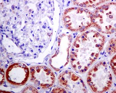 Immunohistochemistry (Formalin/PFA-fixed paraffin-embedded sections) - Anti-Methylmalo<i></i>nyl Coenzyme A mutase antibody [EPR7739] (ab133672)
