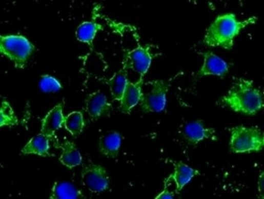 Immunocytochemistry/ Immunofluorescence - Anti-Methylmalo<i></i>nyl Coenzyme A mutase antibody [EPR7739] (ab133672)