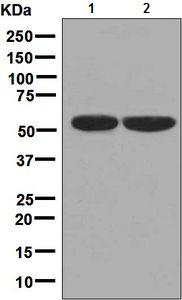 Western blot - Anti-Carboxypeptidase B2  antibody [EPR7858] (ab133679)