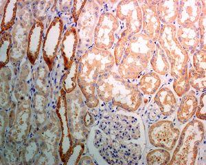 Immunohistochemistry (Formalin/PFA-fixed paraffin-embedded sections) - Anti-Dymeclin antibody [EPR8789] (ab133685)