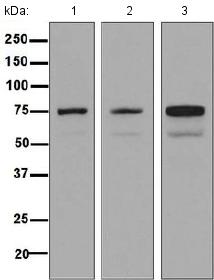 Western blot - Anti-Dymeclin antibody [EPR8789] (ab133685)