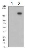 Western blot - Anti-PDGF Receptor alpha (phospho Y720) antibody [EP2478] (ab134068)