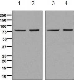 Western blot - Anti-Methylmalo<i></i>nyl Coenzyme A mutase antibody [7738] (ab134956)