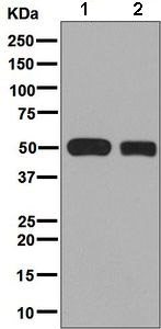 Western blot - Anti-CYP2C19 antibody [EPR6576] (ab137015)