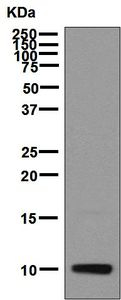 Western blot - Anti-IP10 antibody [EPR7850] (ab137018)