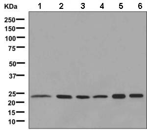 Western blot - Anti-Adenylate Kinase 1 antibody [EP7083] (ab138504)
