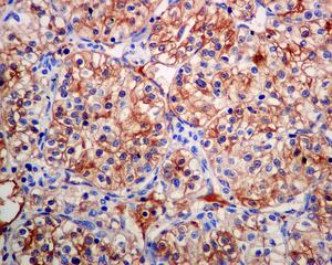 Immunohistochemistry (Formalin/PFA-fixed paraffin-embedded sections) - Anti-BTBD17 antibody [EPR9593(B)] (ab138507)
