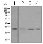Western blot - Anti-Ndufs4 antibody [EPR7831] (ab139178)