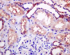 Immunohistochemistry (Formalin/PFA-fixed paraffin-embedded sections) - Anti-Ndufs4 antibody [EPR7831] (ab139178)