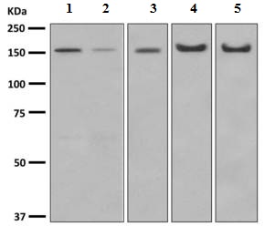 Western blot - Anti-Desmoglein 2 antibody [EPR6768] (ab150372)