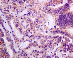 Immunohistochemistry (Formalin/PFA-fixed paraffin-embedded sections) - Anti-Desmoglein 2 antibody [EPR6768] (ab150372)