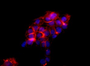 Immunocytochemistry/ Immunofluorescence - Anti-Desmoglein 2 antibody [EPR6768] (ab150372)