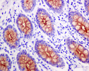 Immunohistochemistry (Formalin/PFA-fixed paraffin-embedded sections) - Anti-MUC4 antibody [EPR9308] (ab150381)