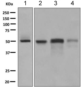 Western blot - Anti-Factor VII antibody [EP6185(2)] (ab151543)