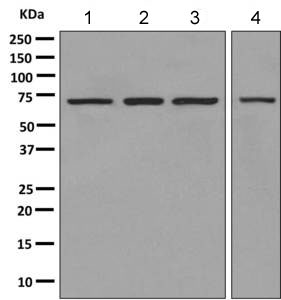 Western blot - Anti-PGM2 antibody [EPR10393(B)] (ab151746)