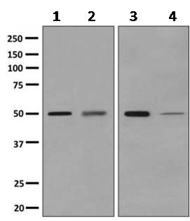 Western blot - Anti-Adenylosuccinate Lyase antibody [EPR10747(B)] (ab154182)