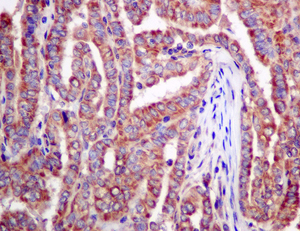 Immunohistochemistry (Formalin/PFA-fixed paraffin-embedded sections) - Anti-Adenylosuccinate Lyase antibody [EPR10747(B)] (ab154182)