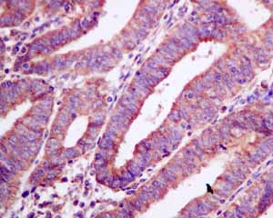 Immunohistochemistry (Formalin/PFA-fixed paraffin-embedded sections)-Anti-Adenylosuccinate Lyase antibody [EPR10747(B)](ab154182)