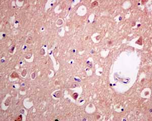 Immunohistochemistry (Formalin/PFA-fixed paraffin-embedded sections)-Anti-Adenylosuccinate Lyase antibody [EPR10747(B)](ab154182)