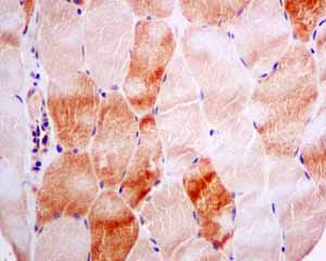 Immunohistochemistry (Formalin/PFA-fixed paraffin-embedded sections)-Anti-Adenylosuccinate Lyase antibody [EPR10747(B)](ab154182)
