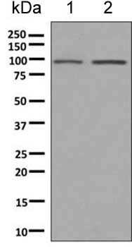 Western blot - Anti-CLCN2 antibody [EPR6492(2)] (ab154798)