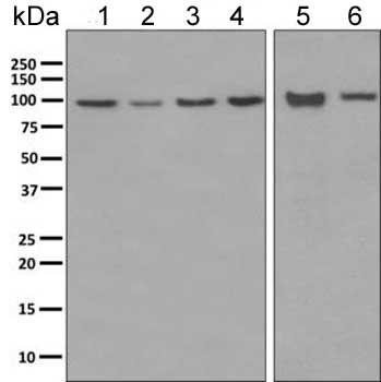 Western blot - Anti-CLCN2 antibody [EPR6492(2)] (ab154798)