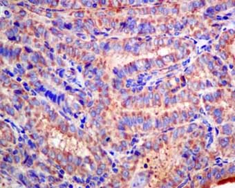 Immunohistochemistry (Formalin/PFA-fixed paraffin-embedded sections) - Anti-CLCN2 antibody [EPR6492(2)] (ab154798)